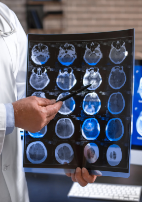 A doctor points to brain scans while discussing them with a patient.